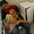 Menino de 3 anos carrega feto de irmão na barriga