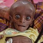A face assustadora do bebê Mihag, condenado à morte pela a fome