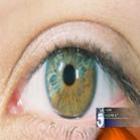 Técnica Muda Cor dos Olhos Com Laser