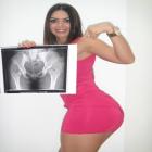 Graciella Carvalho prova com raio X que seu bumbum é natural. 