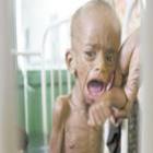 400 mil crianças podem morrer de fome na Somália