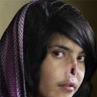 Imagem de afegã desfigurada ganha prêmio de fotografia
