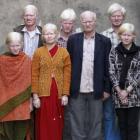 A maior família albina do mundo 