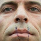 Iraniano faz greve de fome por asilo político e costura a boca