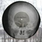 Os malditos LPs feitos com chapas de raio-x