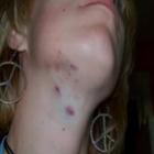 Mulher é atacada por cobra de estimação de 2,5 metros nos EUA