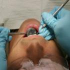 Dentista assume que usava clipes de papel em tratamentos de canal e vai preso 