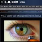 Médico americano diz ser possível fazer olhos castanhos virarem azuis 