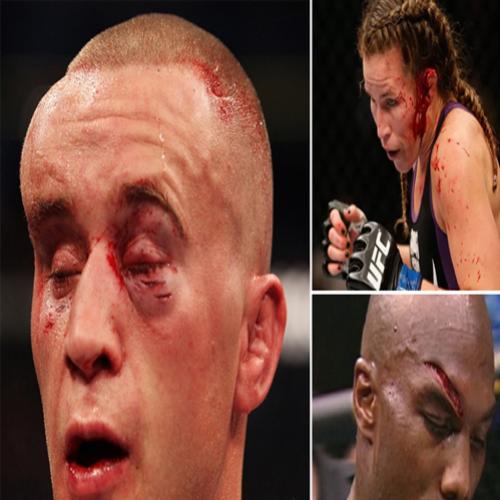 Confira os 15 ferimentos mais marcantes do MMA.