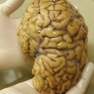 Cientistas criam mais detalhado modelo 3D do cérebro humano (com vídeo