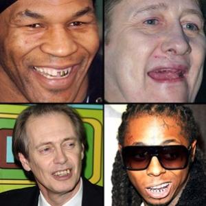 Fotos de celebridades com os dentes feios 
