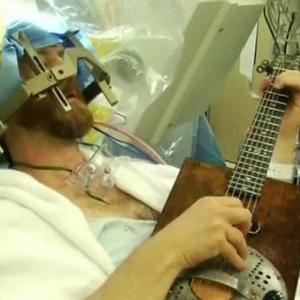 Paciente toca guitarra durante cirurgia no cérebro!