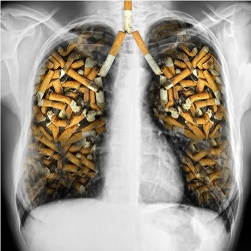  Isso é o que acontece com seu pulmão após fumar 60 cigarros 