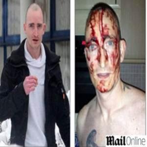 Homem corta o rosto 16 vezes para chamar a atenção da polícia...