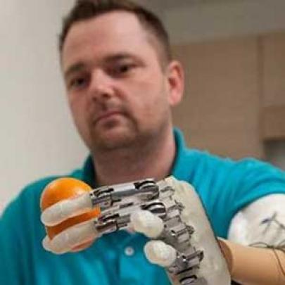 Cientistas desenvolvem prótese de mão que restitui o tato