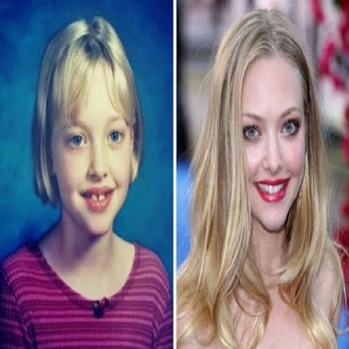 10 belas atrizes da TV antes e depois da carreira