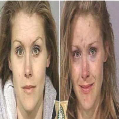 Série de fotos mostra antes e depois de usuários de drogas