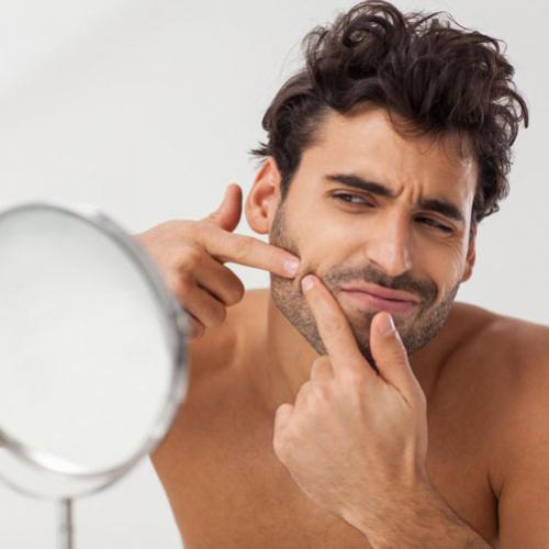 Cuidados com a pele: como evitar espinhas no rosto