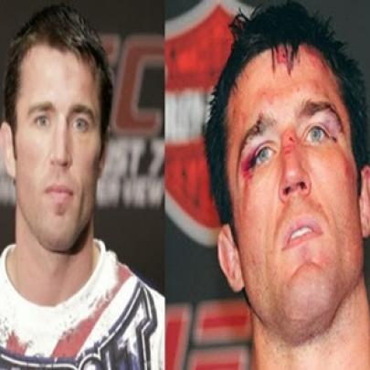 Fotos de lutadores do UFC antes e depois da luta