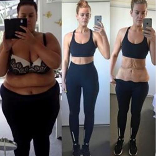 Fotografia, Motivação, Saúde Mulher perde 90 quilos e faz sucesso