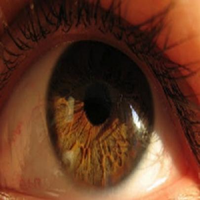 Você Já Viu Como é Um Olho Visto de Perto?