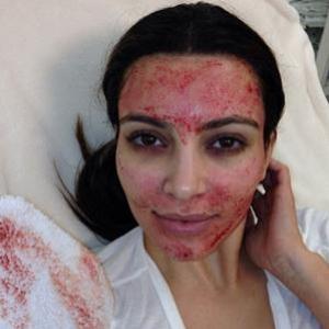 Kim Kardashian passa sangue de verdade na cara pra ficar bonita