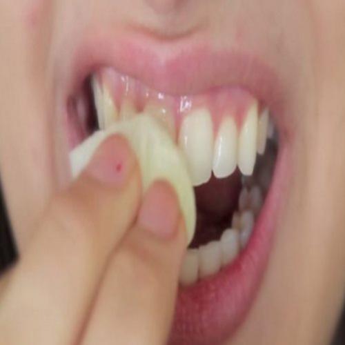 Dentes brancos em apenas 2 minutos! Veja