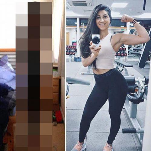 Antes e depois de mulheres bonitas que venceram a anorexia