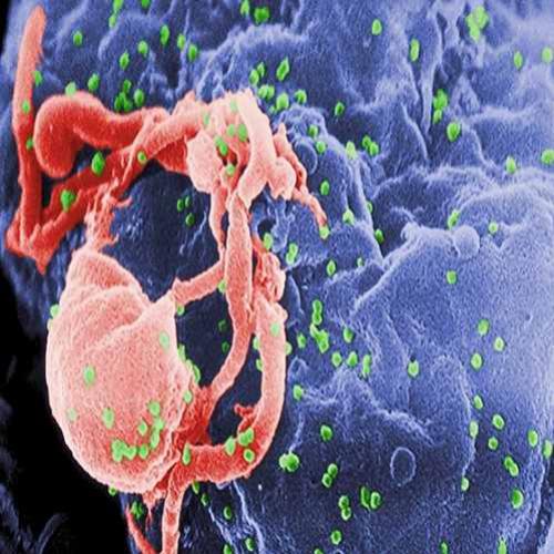 Imagens 'hi-tech' do HIV podem ajudar na criação de vacinas