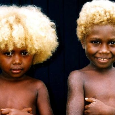 Você já viu negros de cabelos loiros? Conheça o país onde isto é normal!