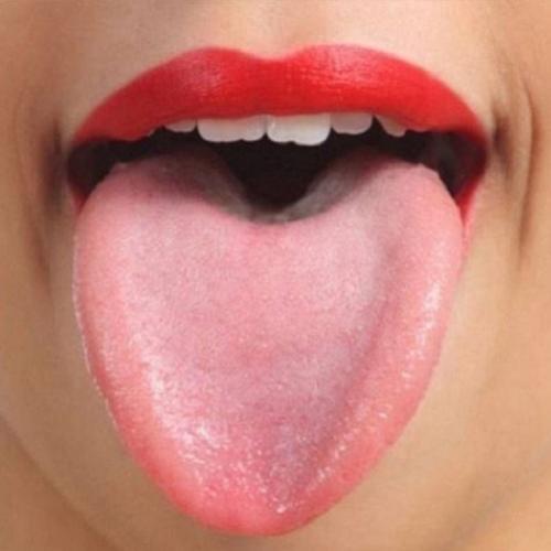 8 Sinais que sua língua dá e que podem dizer sobre a sua saúde