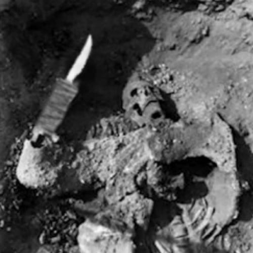 Arqueólogos descobriram um esqueleto com uma estranha prótese.