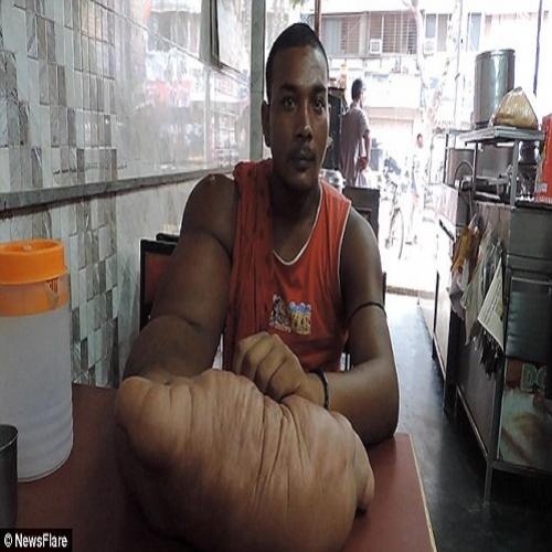 Indiano, “filho do diabo”, com braço de 20 kg é expulso de casa