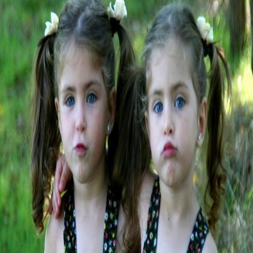 Gêmeos idênticos não possuem o mesmo DNA, diz surpreendente estudo