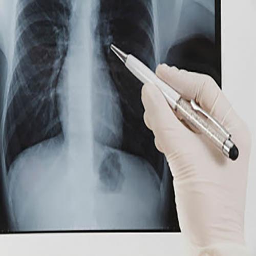 Por que nossos ossos aparecem no raio X?