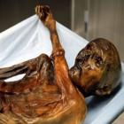Otzi, múmia do gelo, tinha carrapatos e intolerância à lactose
