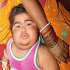 Aos 18 meses de idade, bebê indiano tem barba e bigode