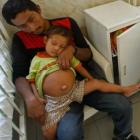 Cirurgiões peruanos retiram feto do abdômen de criança de 3 anos