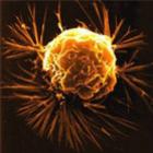 Novo vírus Projetado para matar células cancerosas
