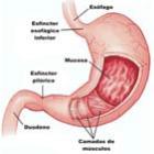 Acidez no estômago, gastrite e úlceras saiba como evitar