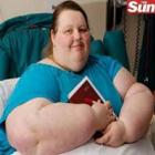 Jovem mais gorda da Inglaterra perde 89 quilos, volta a andar e escreve diário 