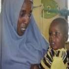 Bebê somali que comoveu o mundo com desnutrição aguda consegue recuperar peso e 