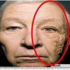 Homem mostra como ficou após tomar sol só de um lado do rosto por 28 anos