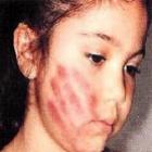 Violência doméstica contra crianças pode gerar traumas na fase adulta