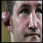 As orelhas deformadas dos lutadores de MMA
