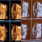 Copia do Ultrassom mostra supermãe prova que supermãe não esta gravida