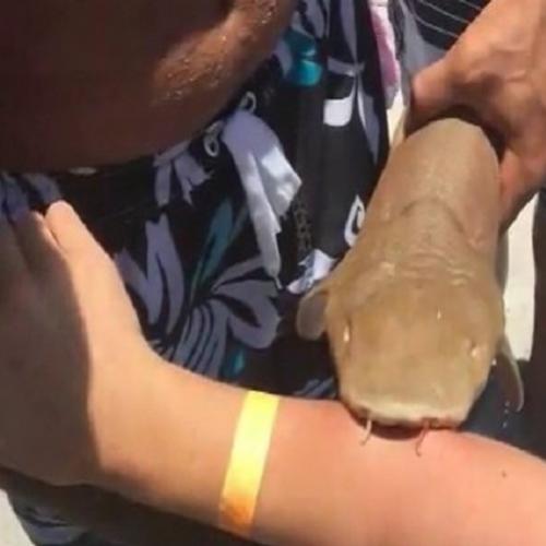  Peixe bagre faz nova vítima em praia de SP 
