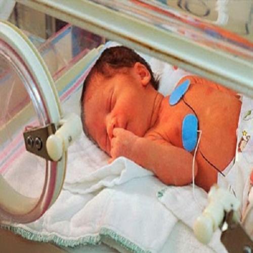 Que cuidados que devemos ter com bebês prematuros?