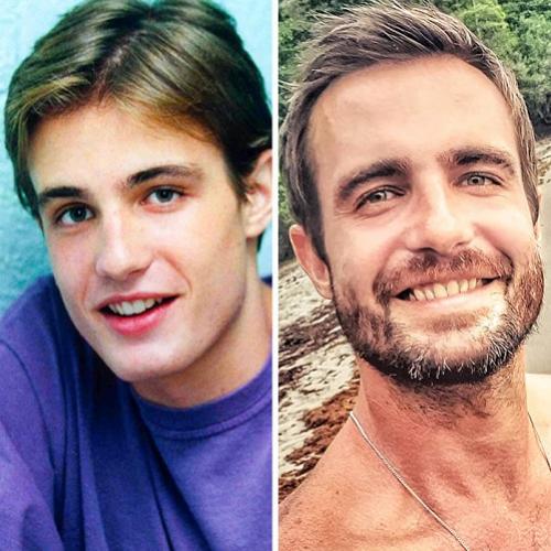O antes e o depois dos atores brasileiros que andam sumidos das telas