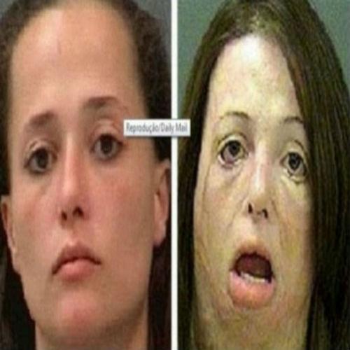 Pessoas antes e depois das drogas químicas